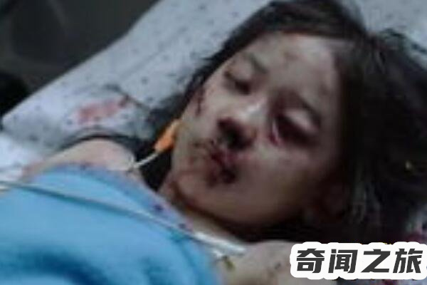 素媛案件真实女孩现在照片（余生当中可能都要带着便袋生活）(5)_
