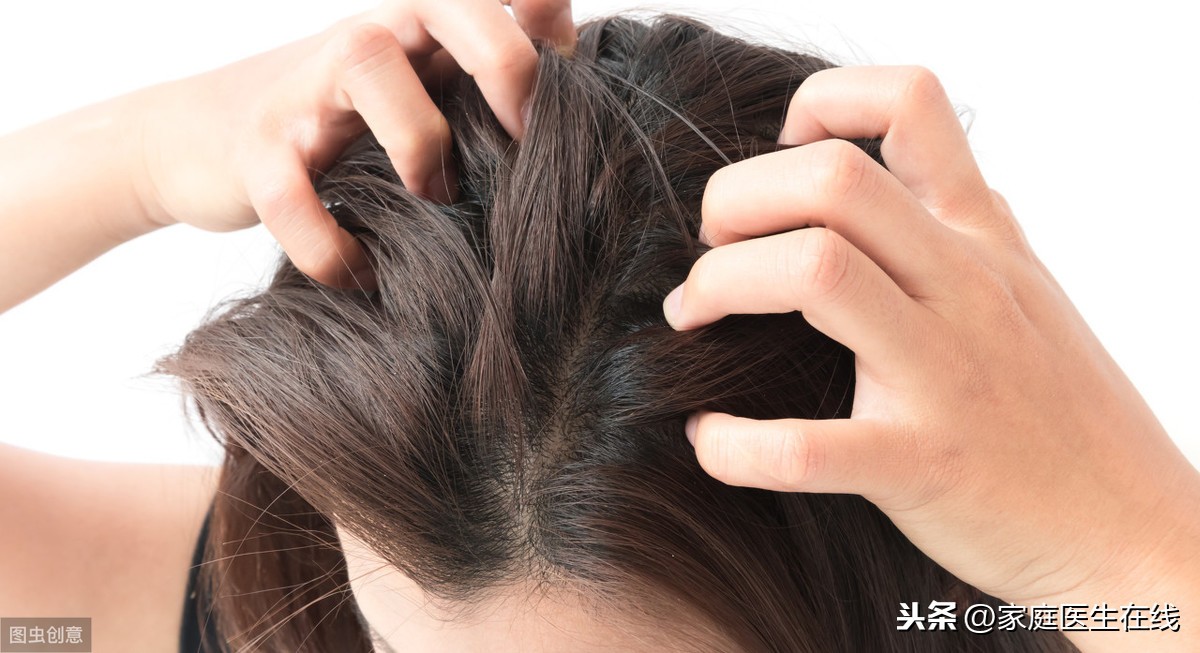 头发油腻是什么原因（头发容易油的4个原因）