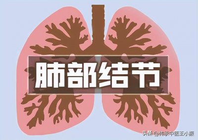 ​消散肺结节的药物有哪些? 消散肺结节的药有哪些